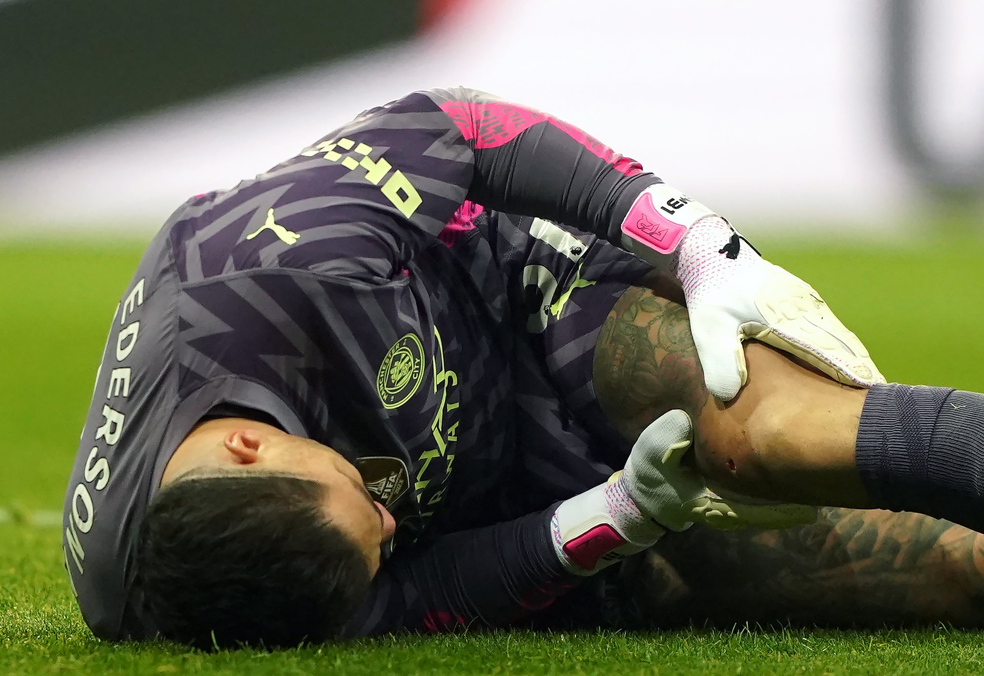 Ederson appeared to be in serious discomfort as he left the field