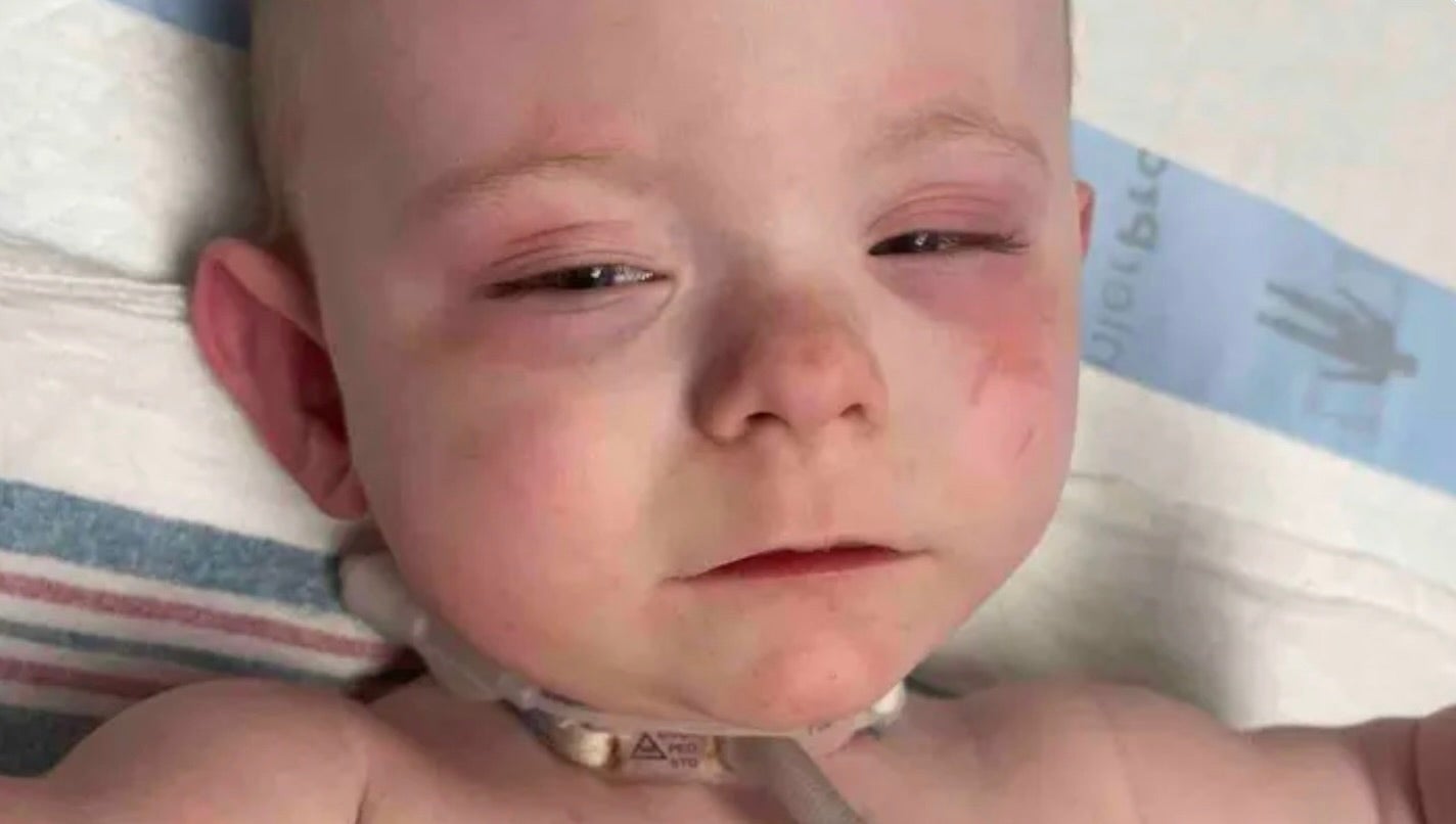 Waylon, the 17-month-old baby boy, who was allegedly harmed by police in a mistaken raid.