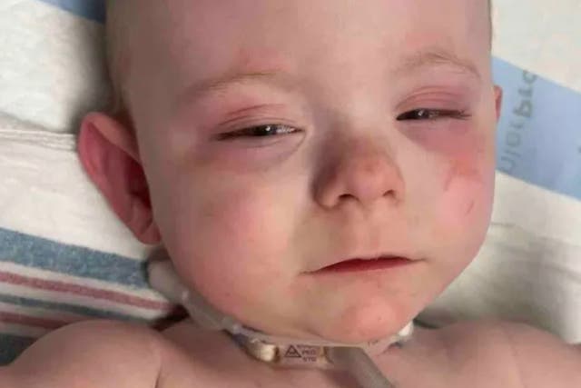 <p>Waylon, the 17-month-old baby boy, who was allegedly harmed by police in a mistaken raid.</p>