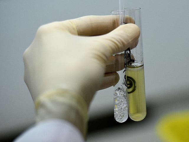 <p>A urine sample at France’s national anti-doping lab near Paris, 2015</p>