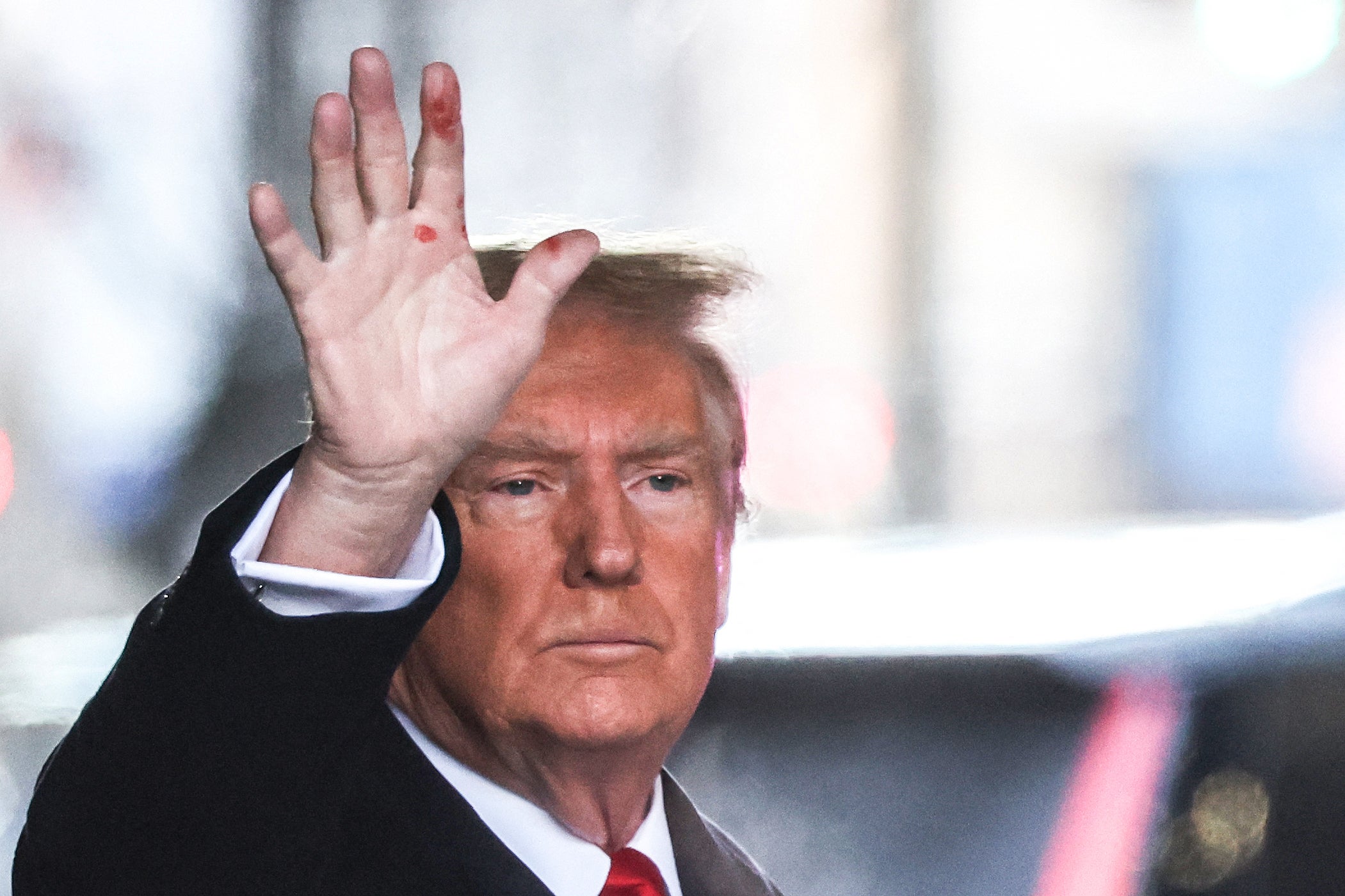 Red Spots On Donald Trump S Hand Spark Speculation The Independent   1932714178 