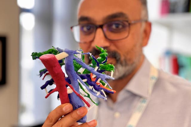 Mr Arjun Takhar, a consultant hepatobiliary and pancreatic cancer surgeon at University Hospital Southampton, and the 3D-printed liver model (PLANETS Cancer Charity/PA Wire)