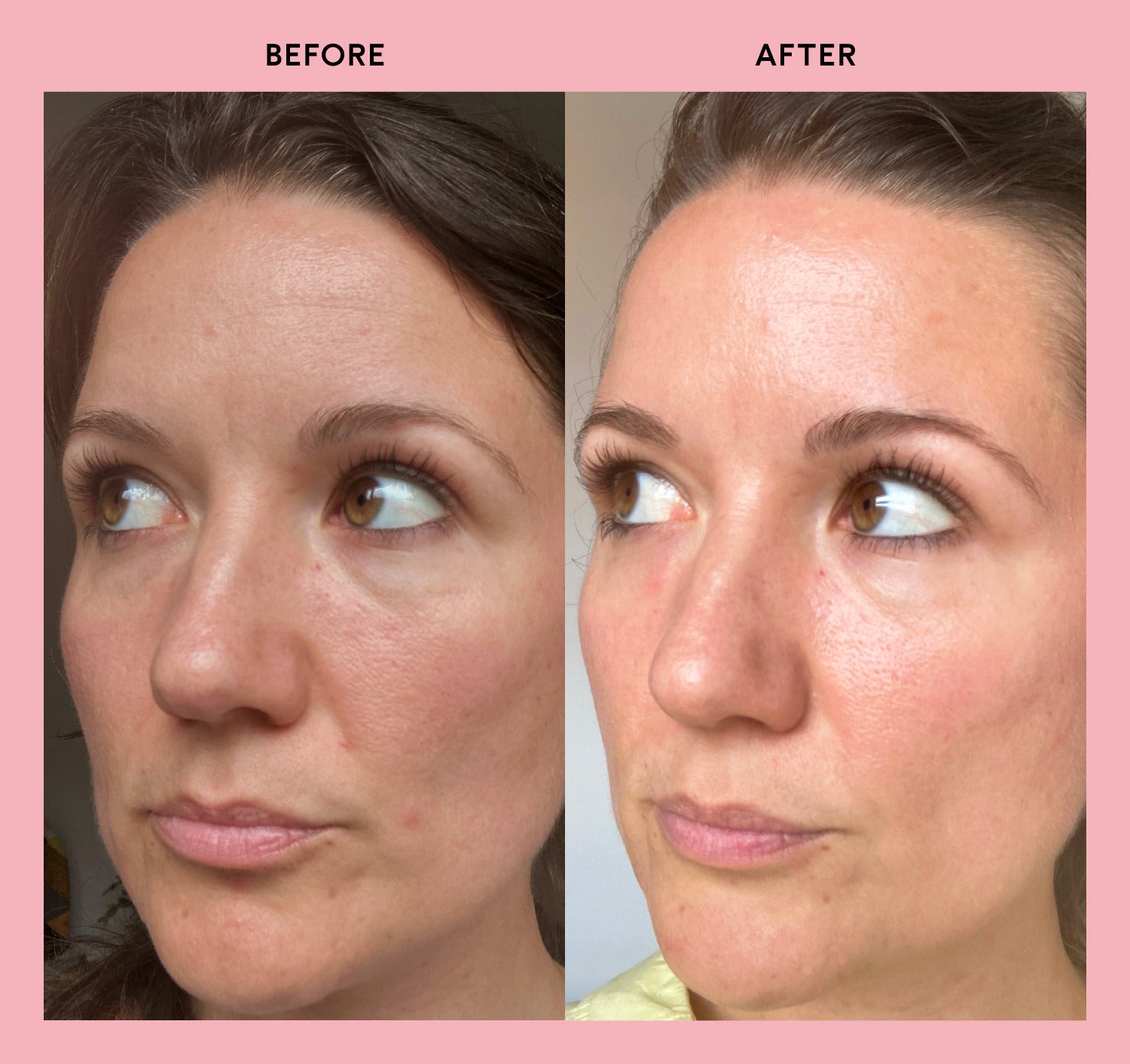 Rachel before and after taking Feel Pro Collagen for 28 days