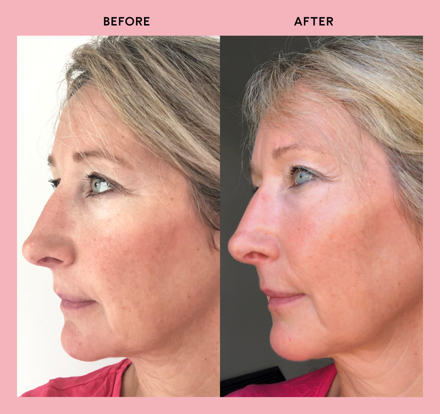 Sarah before and after taking Feel Pro Collagen for 28 days