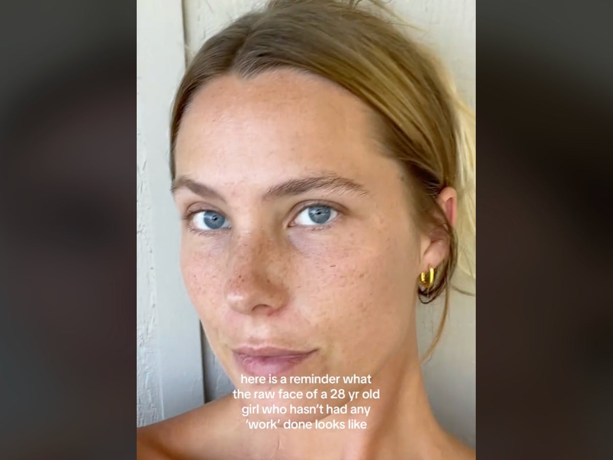 Mom, 28, posted her ‘raw face’ to normalise aging but was met with online vitriol: ‘Sun is eating you up’