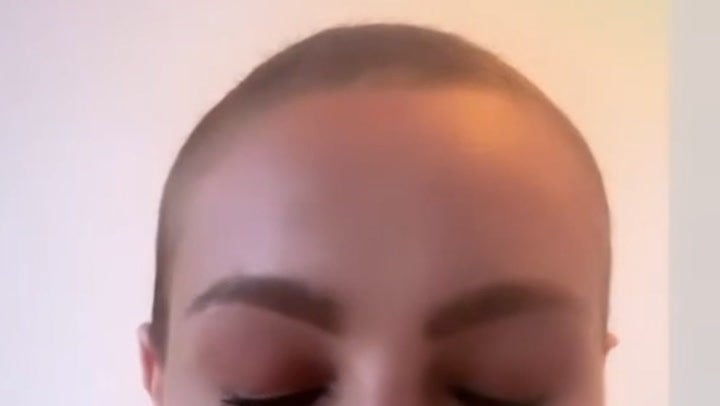 <p>Amy Dowden says she is ‘grateful for the hair growth’ as she shares update.</p>