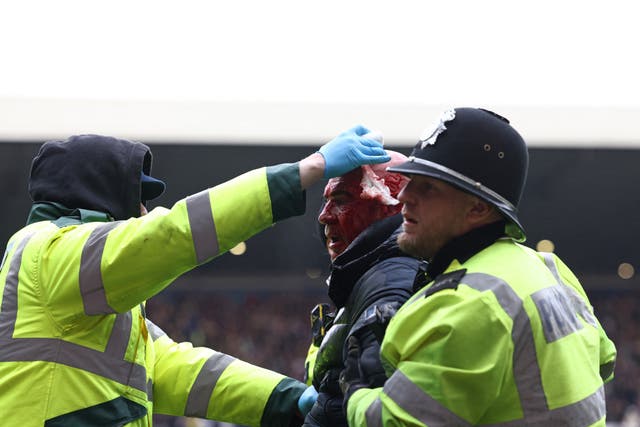 <p>A bloodied fan is led away from the scene by police </p>
