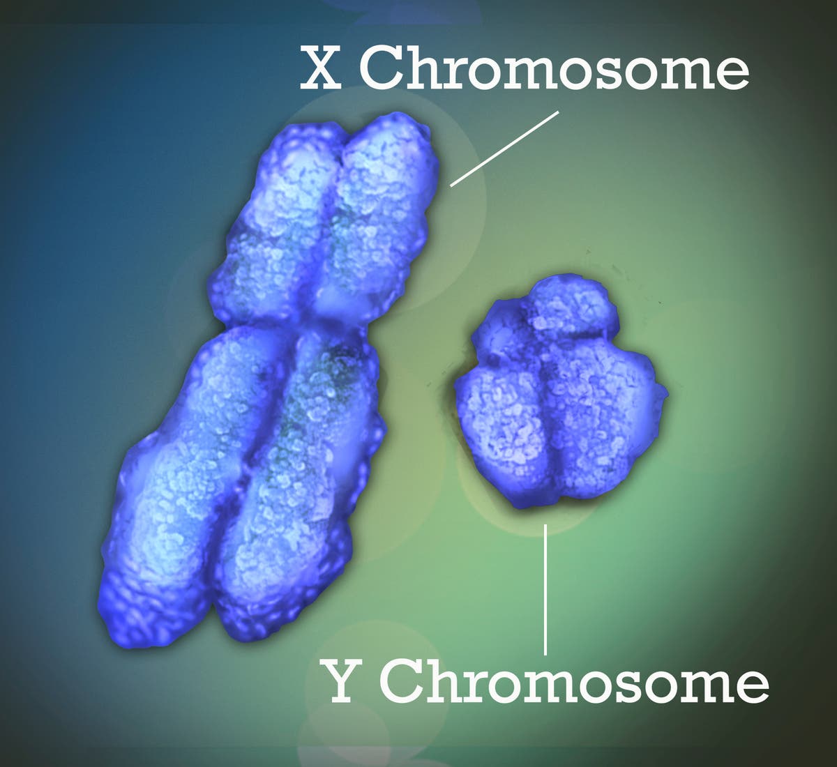 Lupus and other autoimmune diseases strike far more women than men. Now there's a clue why