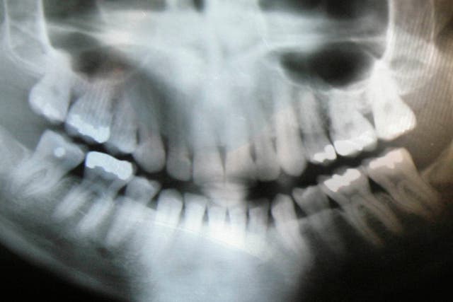 Dental X Rays Apron