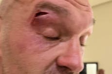 Tyson Fury sparring partner speaks out after causing cut that delayed Oleksandr Usyk fight