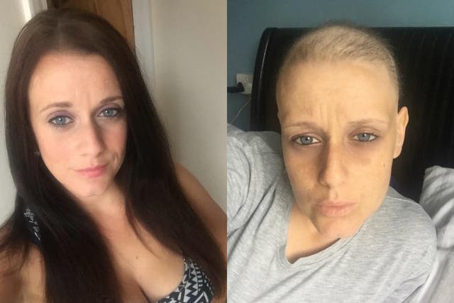 <p>Leanne is now in remission and is encouraging others to appreciate the 'simple things' in life (Collect/PA Real Life)</p>