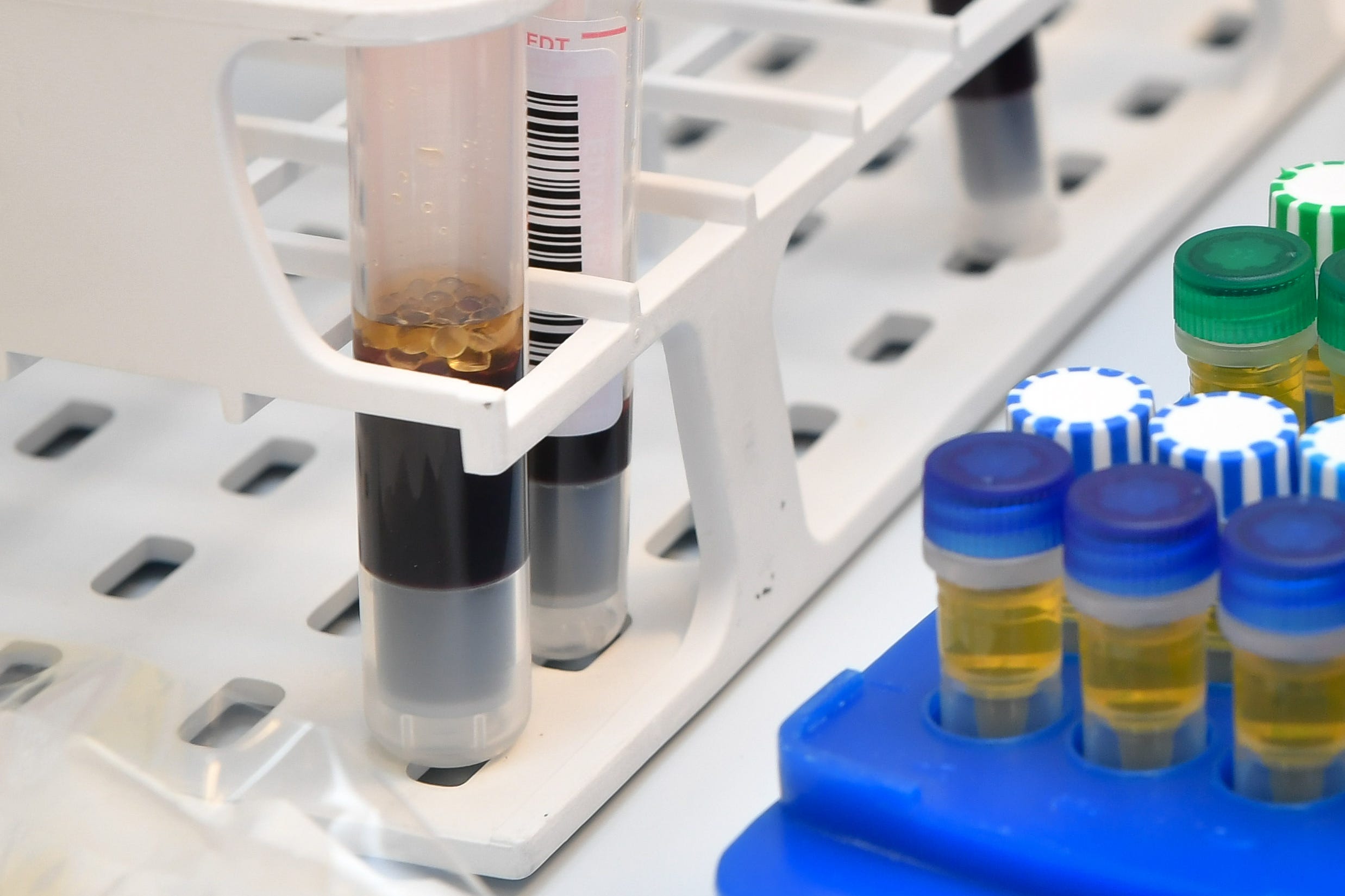 <p>Proteins in the blood can predict dementia years before a diagnosis, research shows </p>