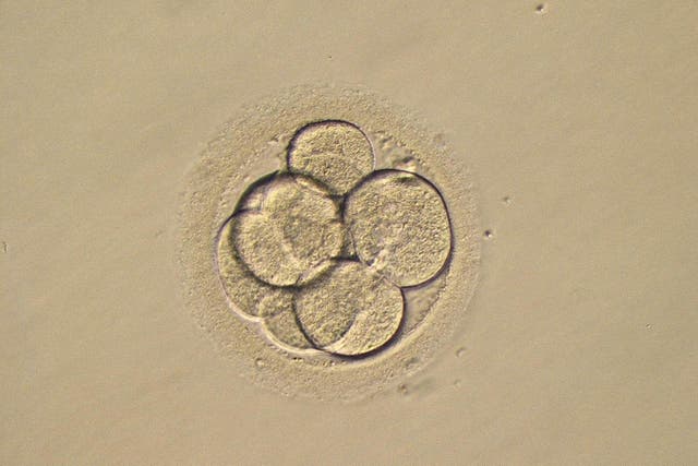 A photo of a three-day-old human embryo (PA)