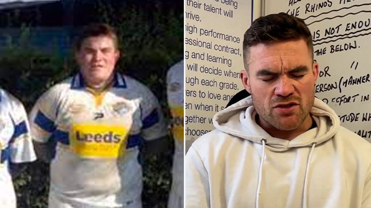 Rugby league player blinded by ‘horrific’ bar glass attack calls for urgent law change
