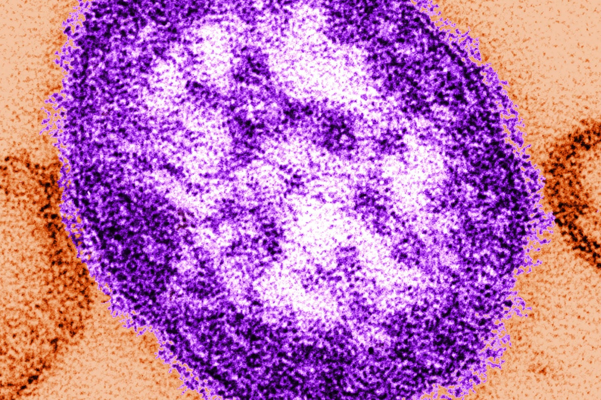 Streeting vows to ‘redouble’ vaccination efforts after measles death