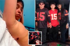 ‘When I heard the gunshots, I hid’: 10-year-old discovered bullet wound at home after Kansas City Chiefs parade