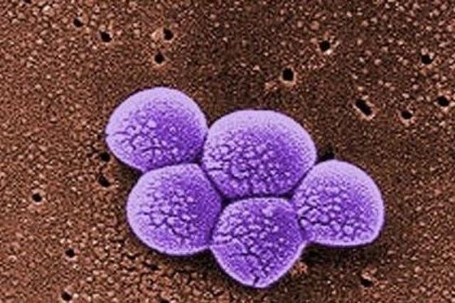 <p>Colorised scanning electron micrograph (SEM) depicts a grouping of methicillin-resistant i>Staphylococcus aureus (MRSA) bacteria.</p>