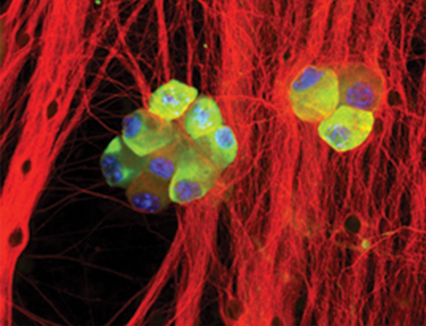 <p>Herpes simplex virus is reactivating from cultures of neurons</p>