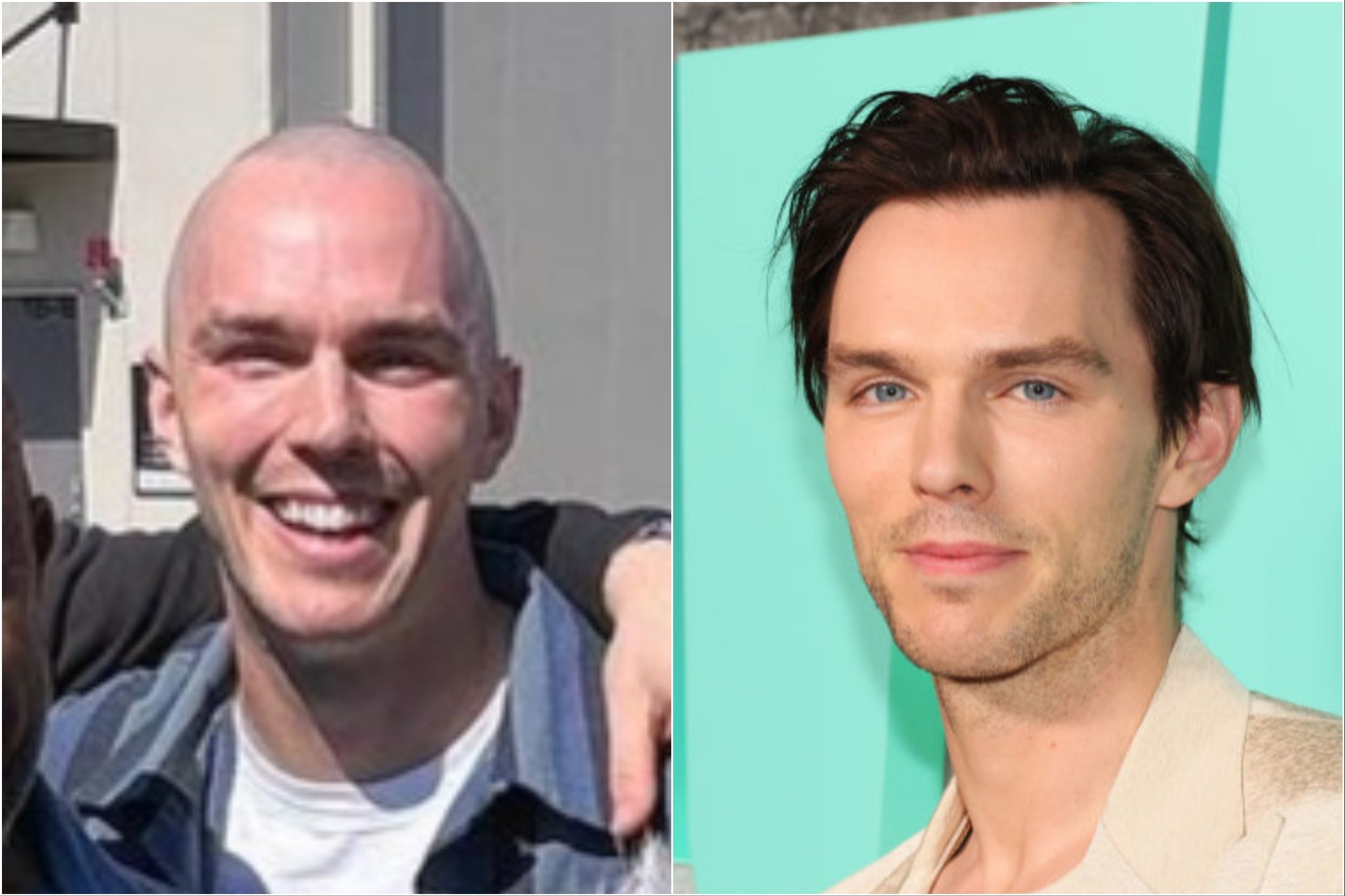 Nicholas Hoult Reveals Shaved Head For Role As Lex Luthor In Superman ...