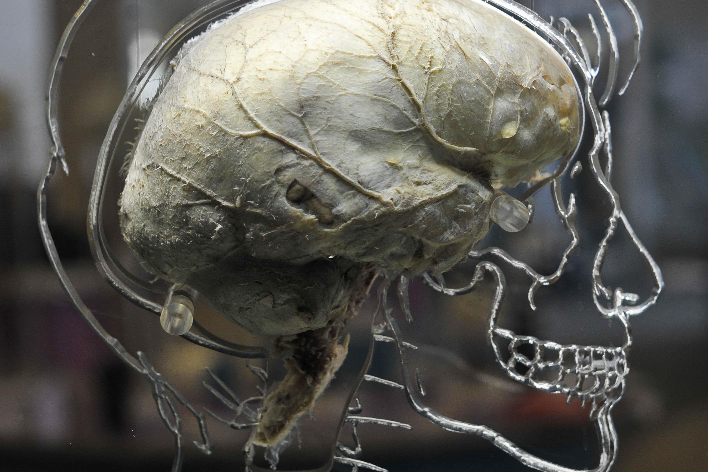 <p>Poor navigation could predict Alzheimer’s years before symptoms appear, a study suggests (Ben Birchall/PA)</p>