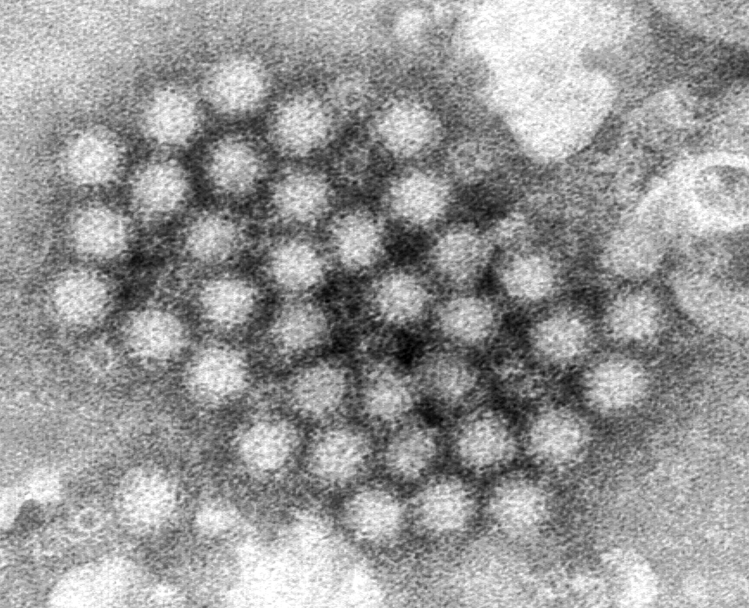 This electron microscope image provided by the Centers for Disease Control and Prevention shows a cluster of norovirus virions