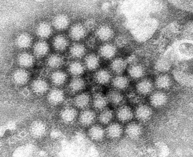 Norovirus Explainer