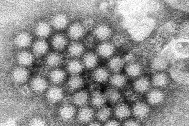 Norovirus Explainer