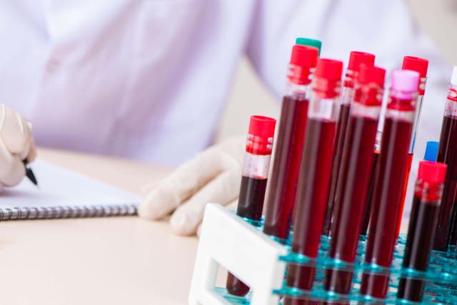 <p>GP practices in London are currently unable to carry out thousands of blood tests a day </p>