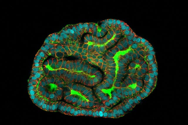 <p>Kidney amniotic fluid organoids resembling renal tubules, as ‘mini organs’ have been grown for the first time using human stem cells </p>
