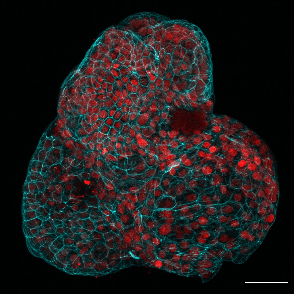 The red colouration indicates a lung stem cell marker used to identify the tissue type, as "mini organs" have been grown for the first time using human stem cells