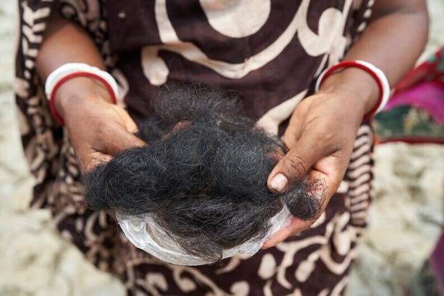 <p>Shyamoli, 50, a local doula, holding hair she believes she has lost as a result of bathing in pondwater contaminated by salt water and farming pesticides</p>