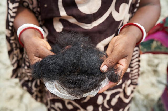 <p>Shyamoli, 50, a local doula, holding hair she believes she has lost as a result of bathing in pondwater contaminated by salt water and farming pesticides</p>
