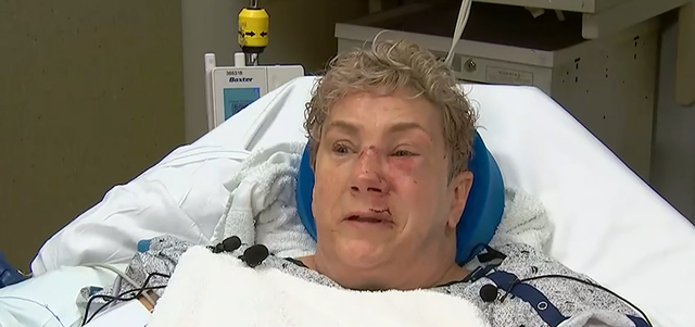<p>Lee Ann Galante, 55, survived a horrific bear attack in her backyard </p>