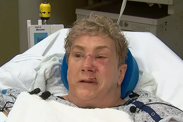 <p>Lee Ann Galante, 55, survived a horrific bear attack in her backyard </p>
