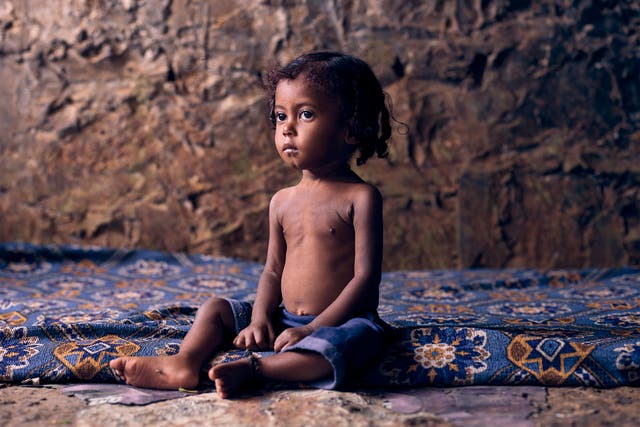 <p>Riam aged 18 months old, has just returned from the malnutrition centre at Al-Sadaqa hospital in Aden, which is a lifeline to families displaced by the conflict in Yemen</p>