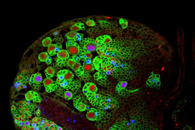 <p>Brain Tumour Research of fruit fly brain cells</p>