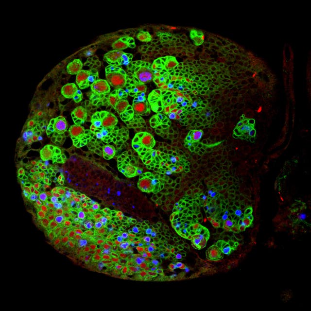 <p>Brain Tumour Research of fruit fly brain cells</p>