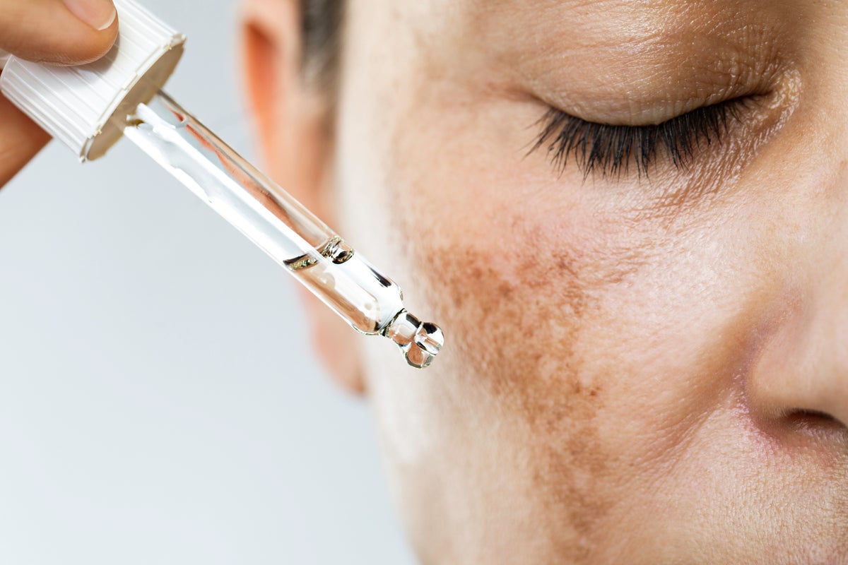What is retinol? The science — and risks — behind the trendy skincare ingredient