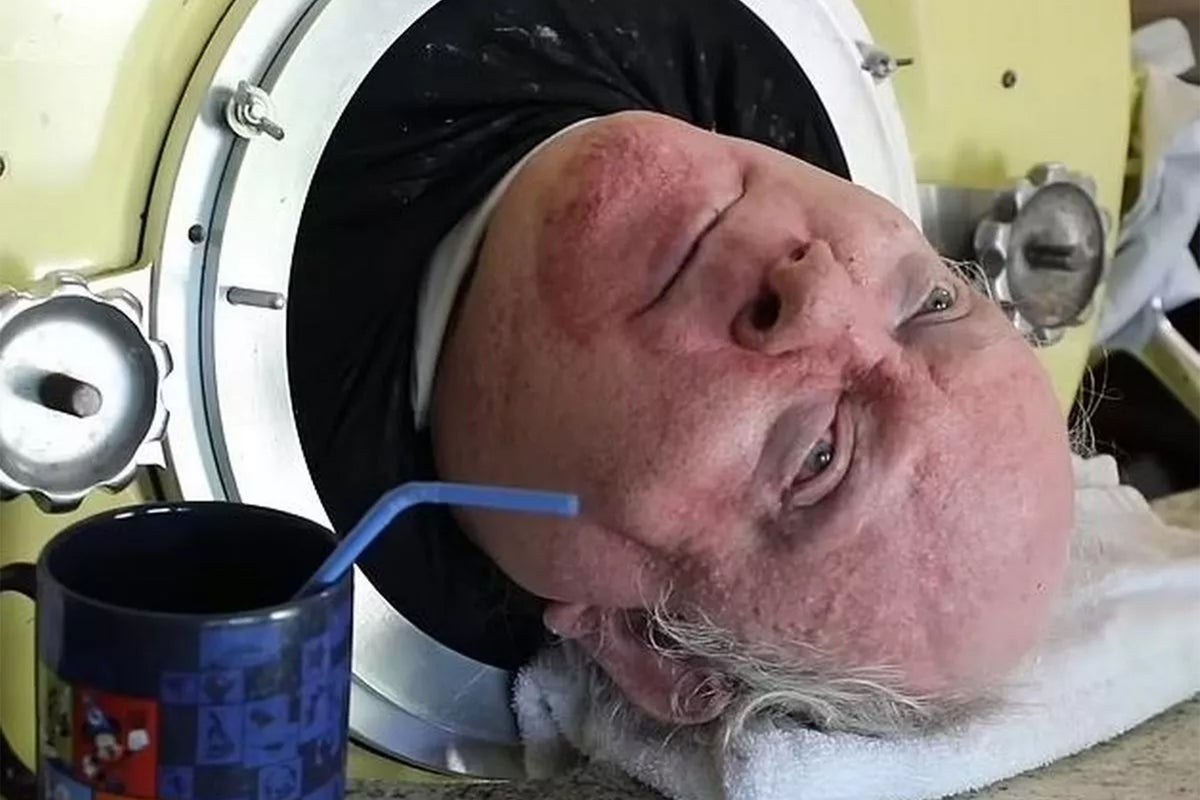 Man dies after living in iron lung for 70 years