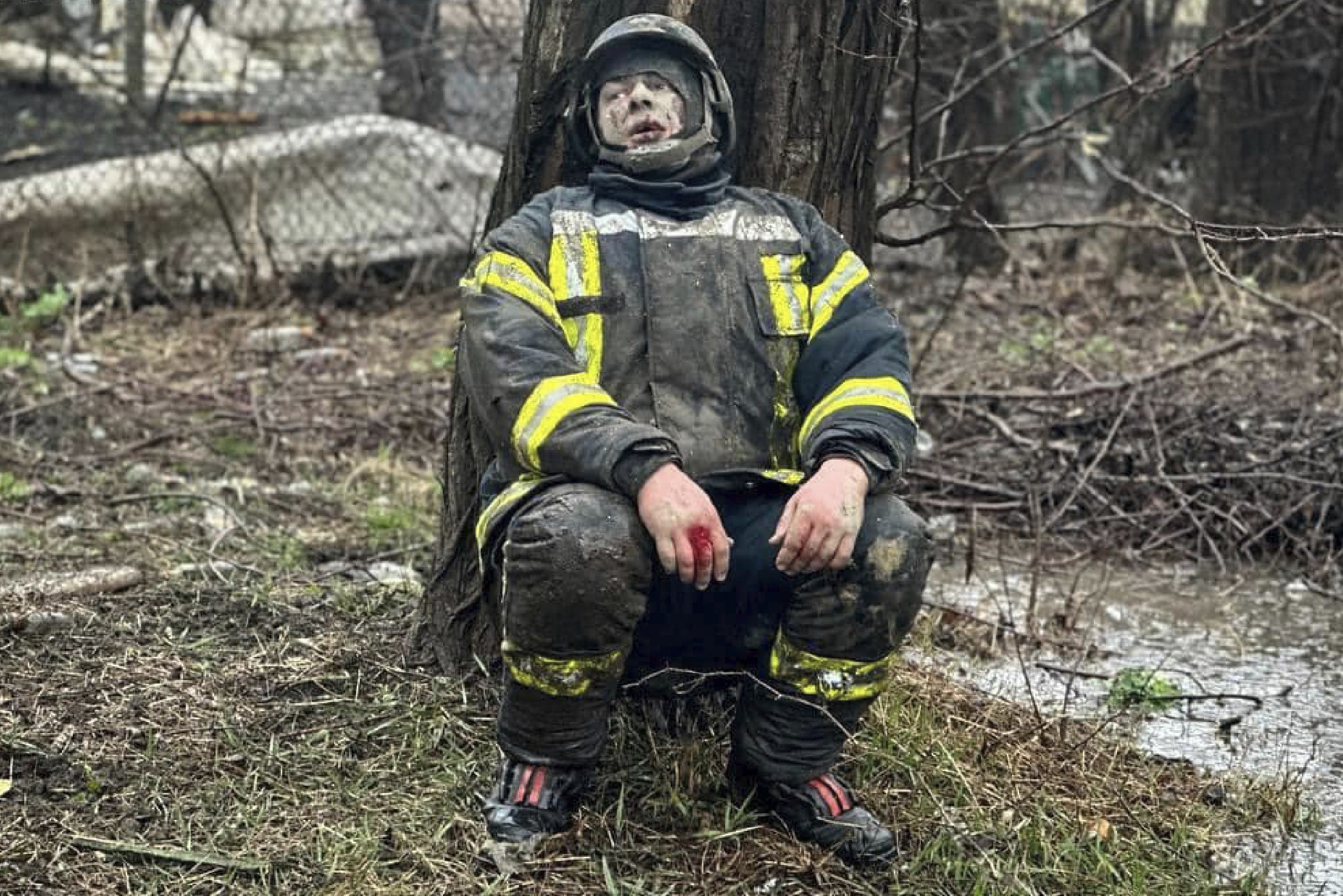 An injured rescuer after the missile attack in Odesa on Friday