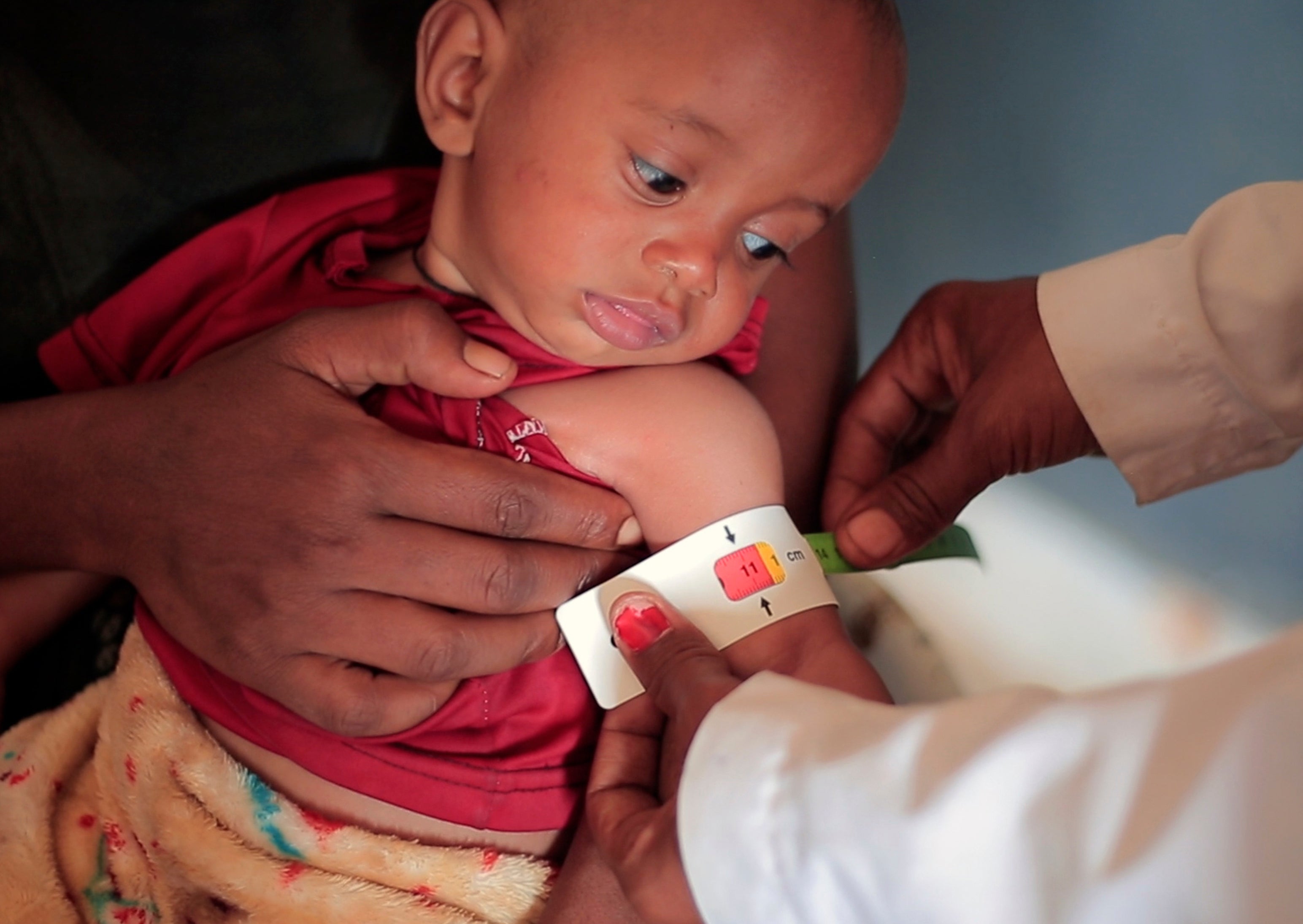 A nurse measures the arm circumference of Temesgen Muluhaw, eight months old, who is suffering from malnutrition, in Mai Mekden, northern Ethiopia