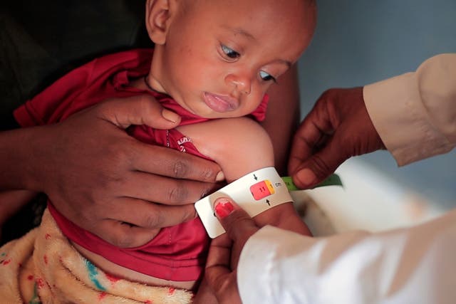 <p>A nurse measures the arm circumference of Temesgen Muluhaw, 8 months-old, who is suffering from malnutrition, at the Finarwa Health Center in Mai Mekden, in the Tigray region of northern Ethiopia, on Tuesday, Feb. 27, 2024</p>