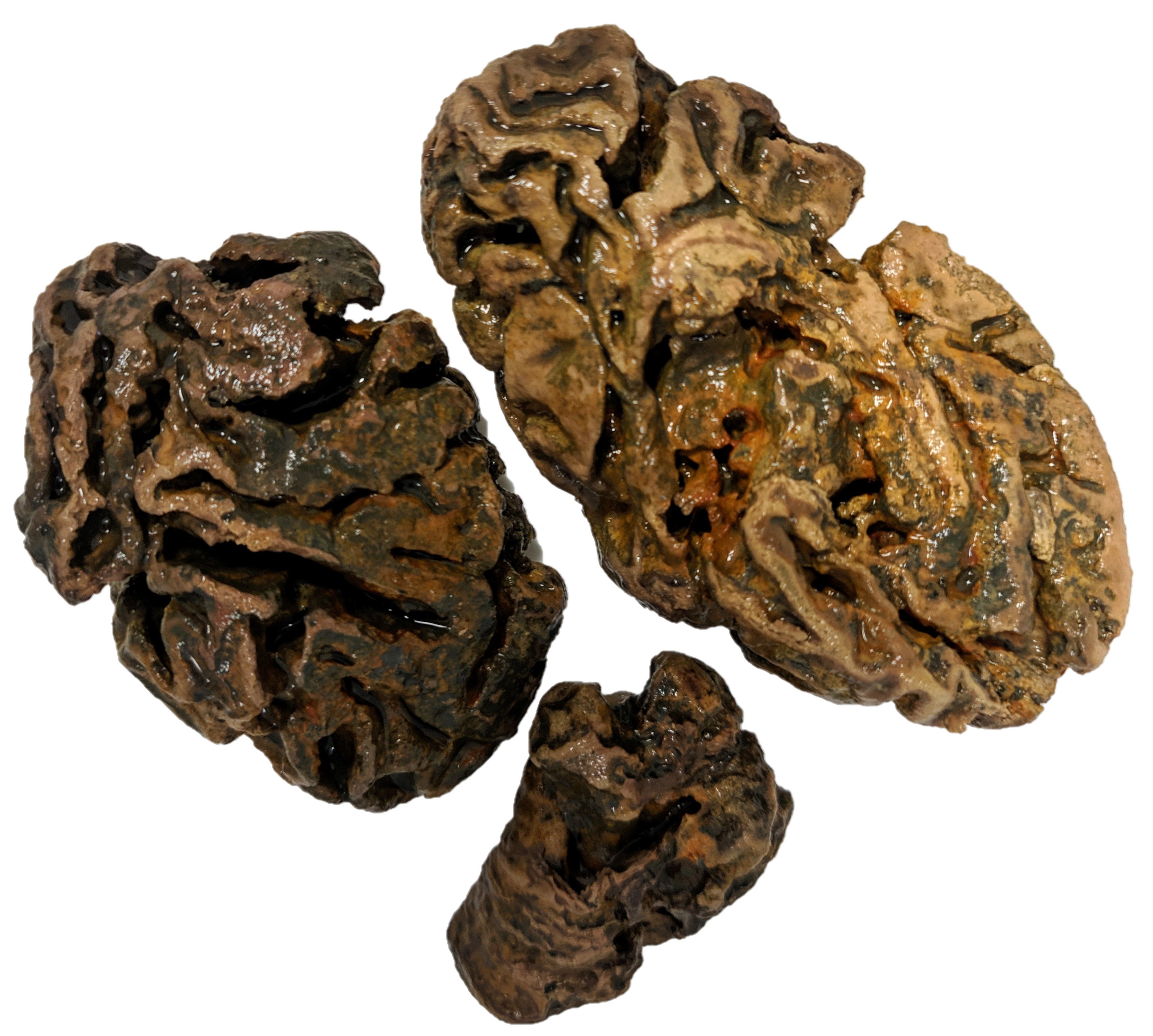 Fragments of the brain from an individual buried in a Victorian workhouse cemetery