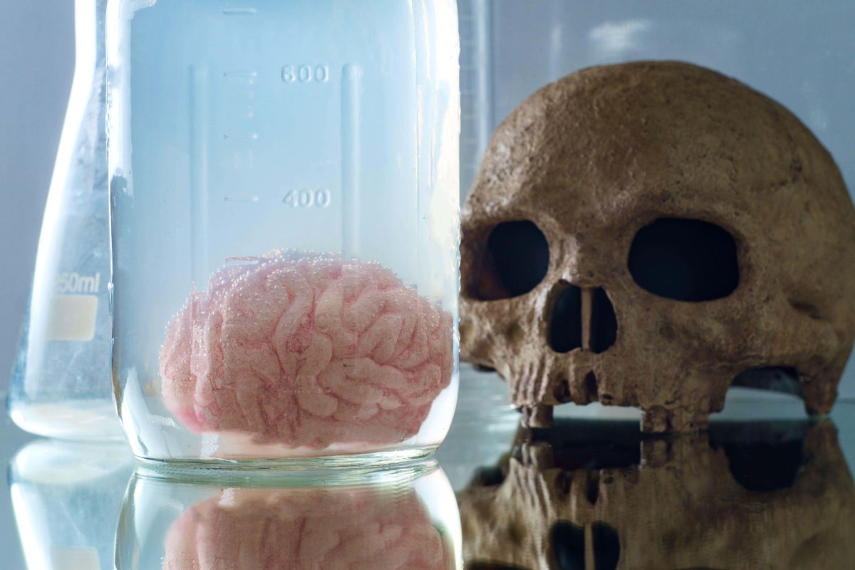 Researchers create new archive of ancient human brains