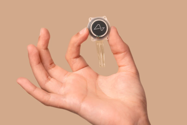 <p>Neuralink’s brain chip enables direct communication with a computer just by thinking</p>