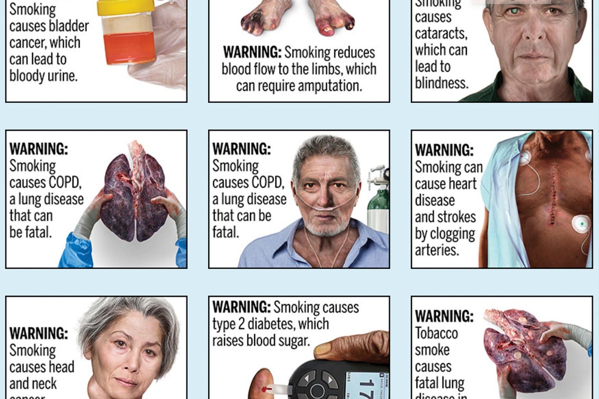 Requiring ugly images of smoking's harm on cigarettes won't breach First  Amendment, court says