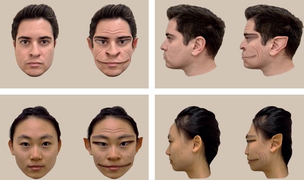 A 58-year-old man with a 31-month history of seeing people’s faces distorted and, in his words appearing “demonic” visited a university laboratory for an assessment