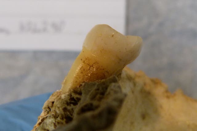 An example of a tooth specimen prior to ancient DNA sampling (Lara Cassidy/Trinity College Dublin/PA)