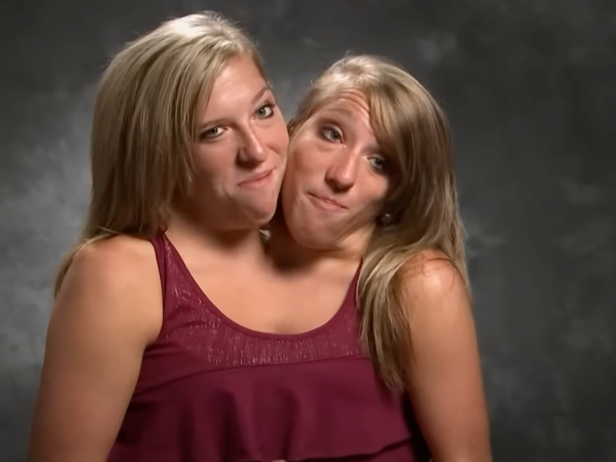 Conjoined twin Abby Hensel from Abby & Brittany is married | The Independent