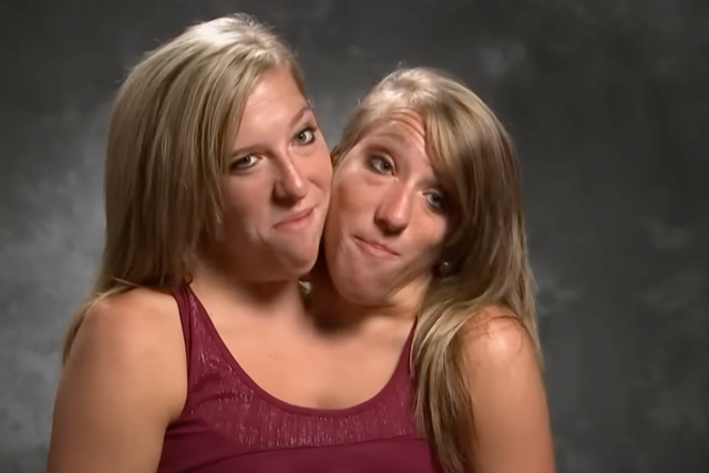 <p>Conjoined twin Abby Hensel from Abby & Brittany privately married army veteran</p>